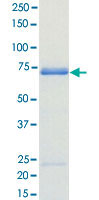 Loading 1 &mu;g protein in SDS-PAGE